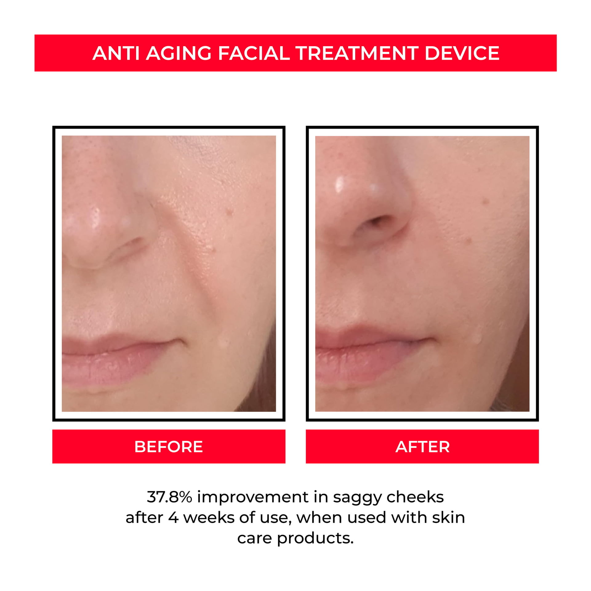 Anti Aging Facial EMS Device